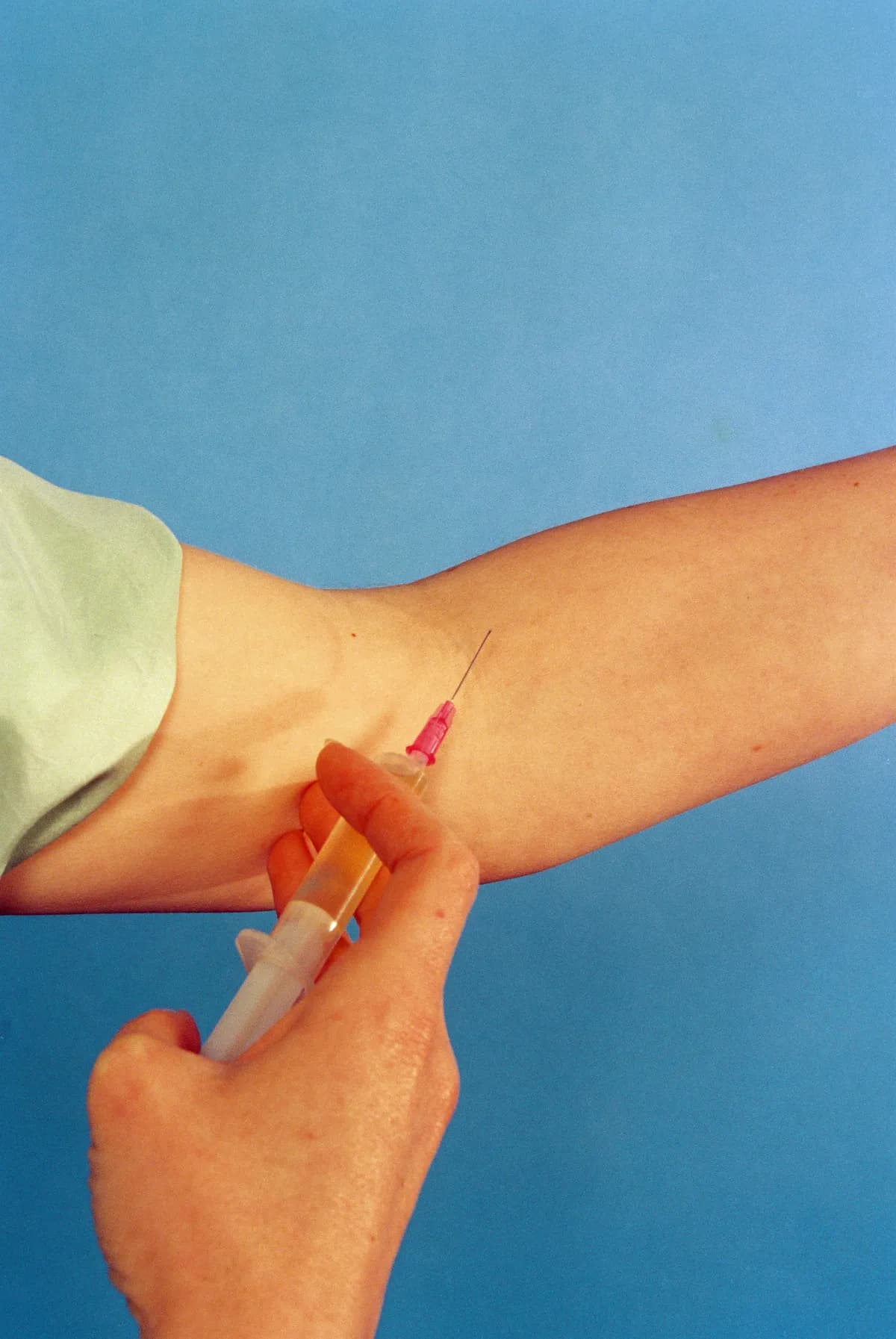 Ungdomstrend: Oreglerade peptidinjektioner väcker säkerhetsvarningar